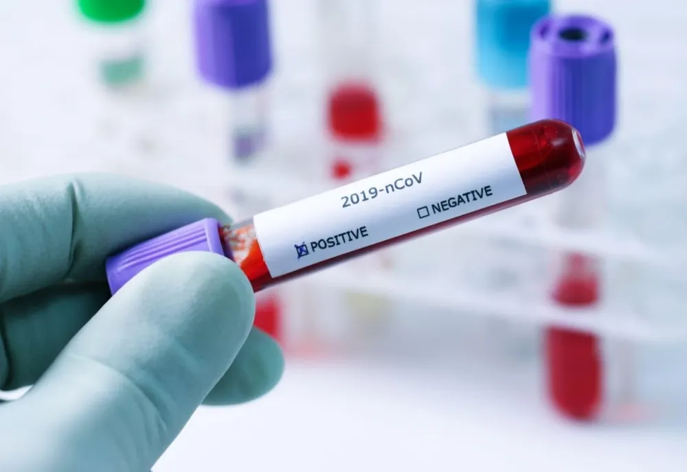 Bilanț coronavirus 23 decembrie: 775 cazuri noi și 81 decese dintre care 44 anterioare