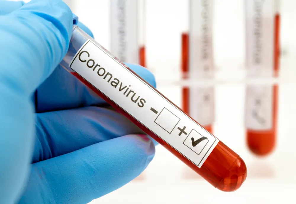  270  de cazuri de coronavirus în județul Constanța 