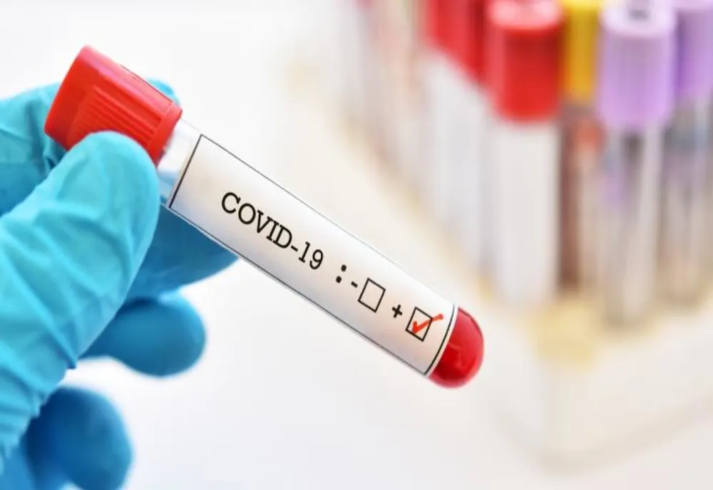 245 de cazuri noi de coronavirus, în ultimele 24 de ore. Unul singur în Constanța
