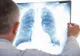 VIDEO|„It’s time.” Campanie împotriva tuberculozei