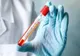 CORONAVIRUS Constanța. 5 cazuri confirmate, 650 persoane autoizolate