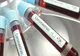 336  cazuri de coronavirus în județul Constanța. Situația în țară