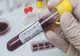  O mamă a plecat cu copilul de două luni din spital, după ce au fost confirmați cu coronavirus